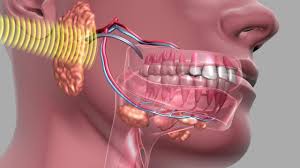 مراجعه به موقع به پزشک جهت درمان سرطان دهان