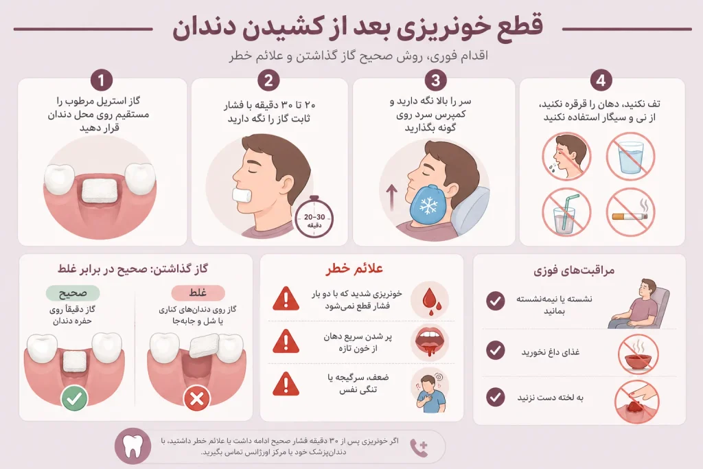 قطع خونریزی بعد از کشیدن دندان
