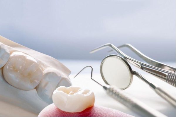 تفاوت روکش دندان و لمینت سرامیکی دندان در چیست؟