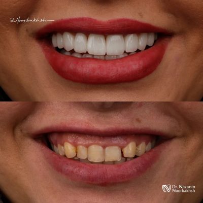 طراحی لبخد 5